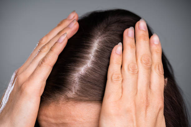 donna con i capelli assottiglianti - loose hair foto e immagini stock