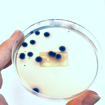 48 hours old culture of Klebsiella pneumoniae grown on chromogenic agar. The spread of Enterobacteriacea producing carbapenemases, is causing an unprecedented public health crisis. Carbapenemase-producing enterobacteria infect mainly hospitalized patients but also have been spreading in long-term care facilities. Given their multidrug resistance, therapeutic options are limited