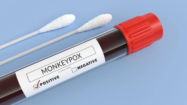 tubo de teste de sangue positivo monkeypox com cotonetes de algodão - transgenic cotton - fotografias e filmes do acervo
