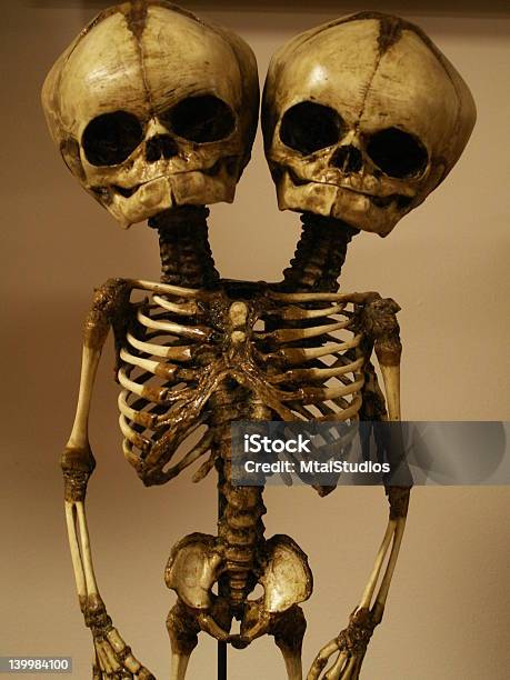 Skeleton Of Conjoined Twins Stock Photo - Download Image Now - Human Skeleton, Human Bone, Human Rib Cage