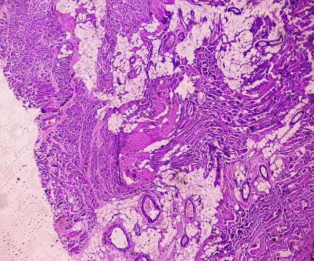 横紋筋腫を示す組織学的組織研究の顕微鏡図。 - adductor magnus ストックフォトと画像