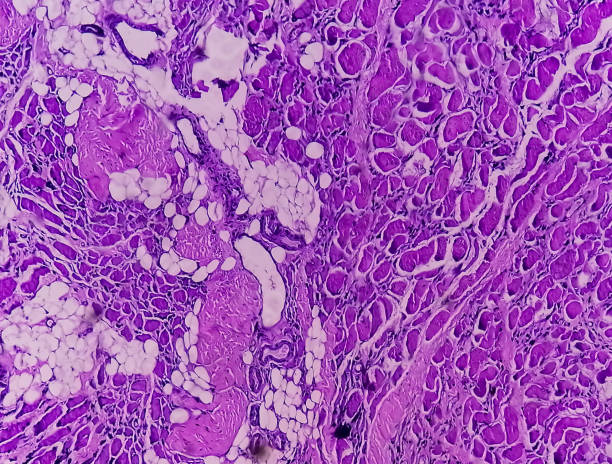 横紋筋腫を示す組織学的組織研究の顕微鏡図。 - adductor magnus ストックフォトと画像