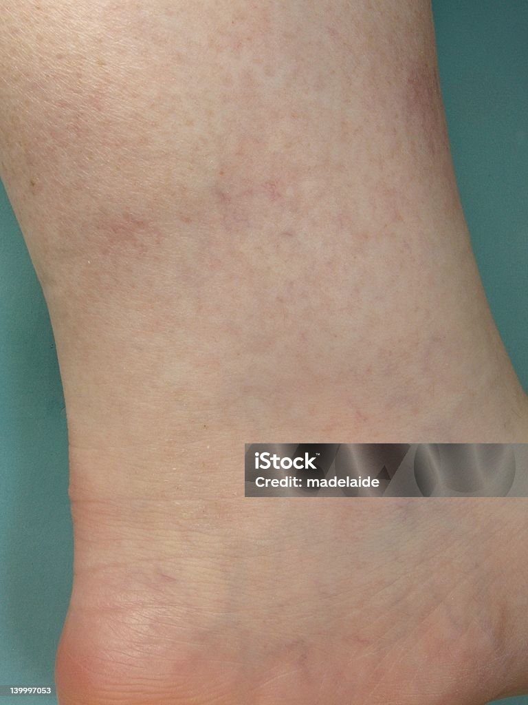 Les veines sur pied - Photo de Articulation du corps humain libre de droits