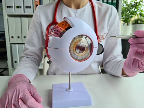 istock Ophthalmologist holds part of eye model eye sample 1399981555