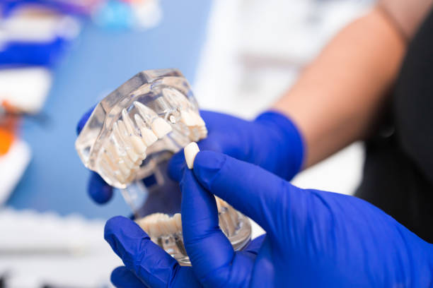istock Dentist holding an artificial lower jaw. Dental Prosthesis. tooth plate. Prosthetics work 1399993820