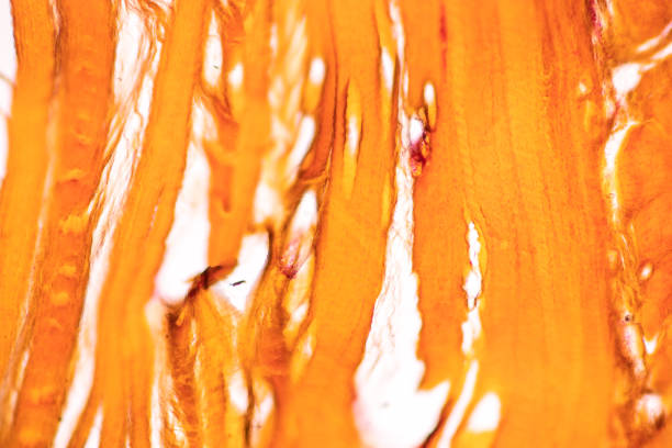 istock White fibrous cartilage of human under the microscope in Lab. 1399995554