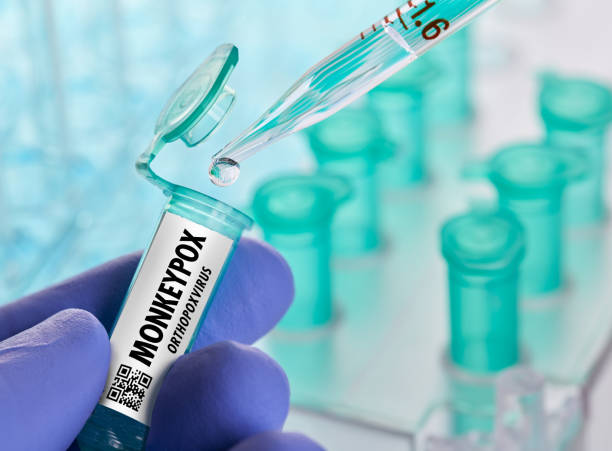 istock Monkeypox virus in laboratory with pipette placing drop in vial with hand holding 1400013109