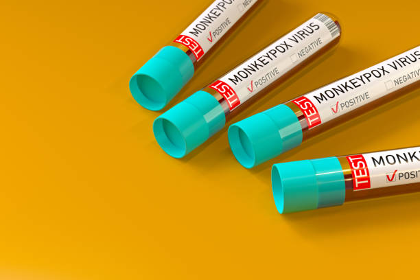Monkeypox virus test tubes. 3D Rendering stock photo