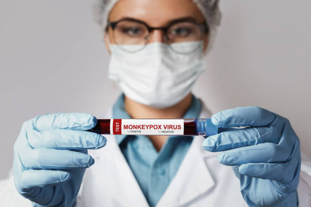 Female nurse with vacutainer with monkeypox blood sample for test stock photo