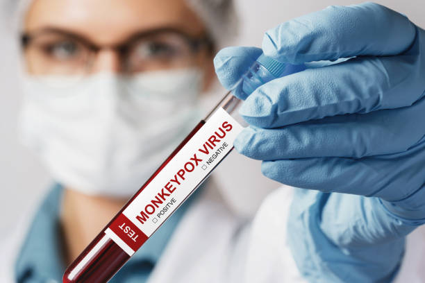 Female nurse with vacutainer with monkeypox blood sample for test stock photo
