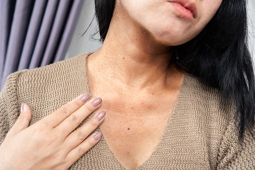 closeup woman having a problem with neck wrinkles, dark skin, aging process because of sunspot