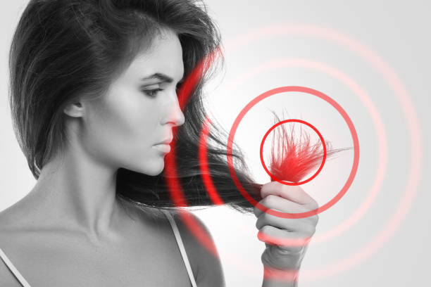 Bad hair condition indicate nutrition and health issues stock photo