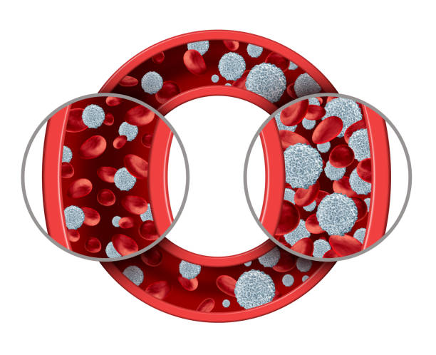 白血病血液疾患 - blood cell formation ストックフォトと画像