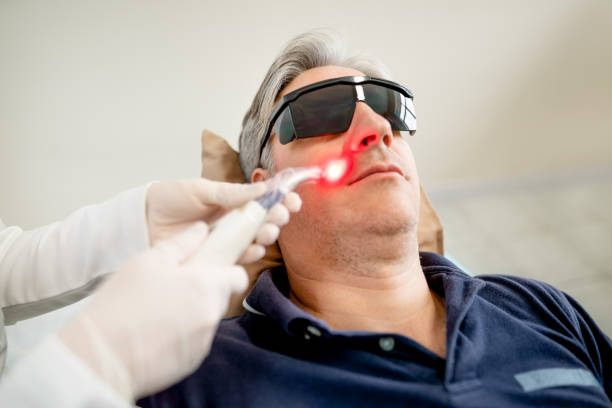 mature man receiving laser treatment in cosmetology clinic - lifting device imagens e fotografias de stock