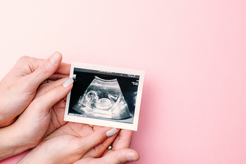 Ultrasound image pregnant baby photo. Woman hands holding ultrasound pregnancy picture on pink background. Pregnancy, medicine, pharmaceutics, health care and people concept