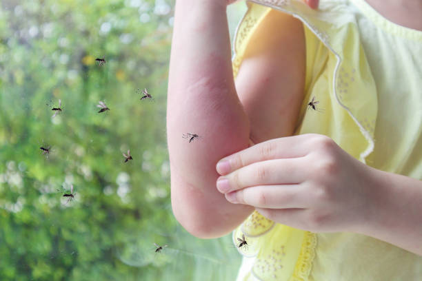 la petite fille a une allergie aux éruptions cutanées et des démangeaisons au bras dues à la piqûre de moustique - moustique photos et images de collection