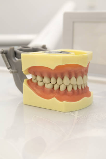istock plastic denture with details on the teeth, molars, gums, bite and smile design, object in studio 1400175417