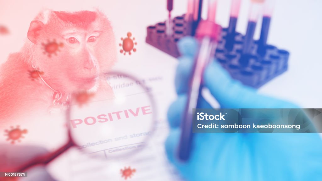 A magnifying glass that zooms in on information about monkeypox test results in a lab. A magnifying glass that zooms in on information about monkeypox test positive results in a lab. Mpox Stock Photo