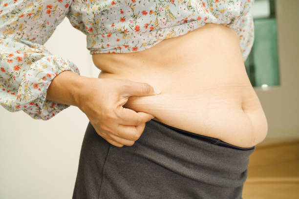 太りすぎのアジアの女性は、脂肪腹を絞るために手を使用して示しています。 - fat burning ストックフォトと画像