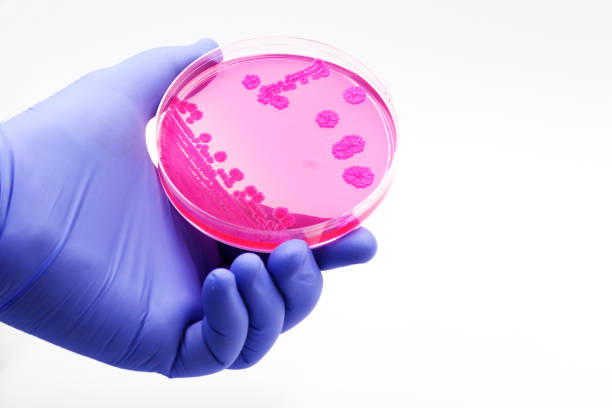 mano di un medico o ricercatore con una coltura a piastra di microrganismi rosa - petri dish bacterium science laboratory foto e immagini stock