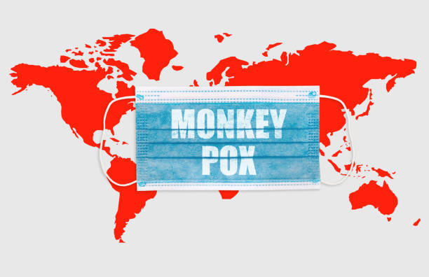 istock Face masks with inscriptions MONKEY POX. Monkey pox outbreak around the world 1400365858