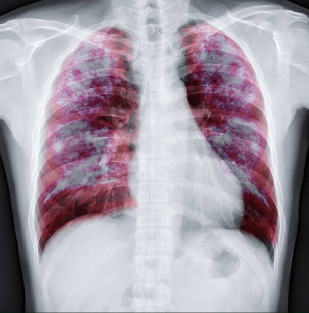 肺 3d レンダリング イメージ。 - pulmonary valve ストックフォトと画像
