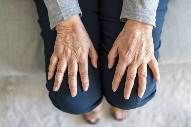 istock Senior woman suffering from arthritis 1400403867