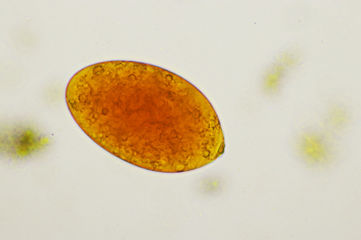 Egg of intestinal fluke in human stool, analyze by microscope, original magnification 400x