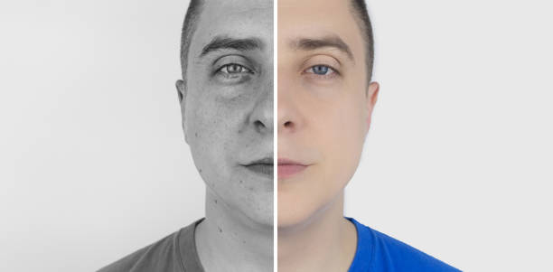 istock Ultraviolet rays on skin. Protective creams test. On the left, the skin is unprotected and stains from UV exposure are visible on it. On right, skin is clean under the protection of special products. 1400569658