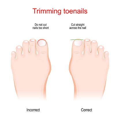 Trimming toenails. Incorrect and Correct