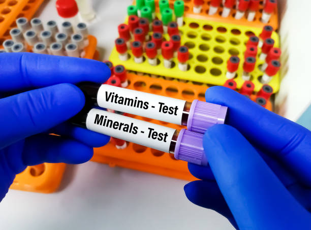 Scientist hold two blood sample one is order for Vitamins test another is Minerals test with laboratory background. stock photo