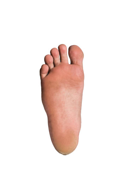 istock foot or pair of bare feet on isolated background 1400759318