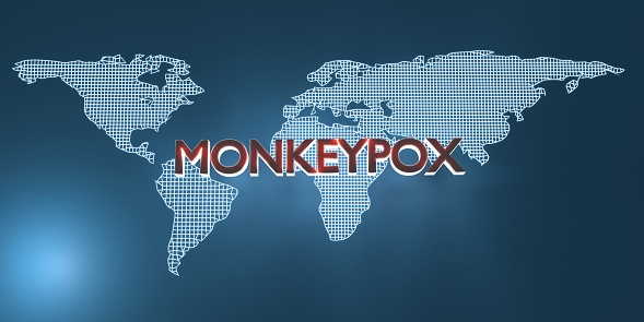 Monkeypox title over globe against blue background. Easy to crop for all your social media and print sizes. Monkeypox stock market and finance concept in horizontal composition with copy space.