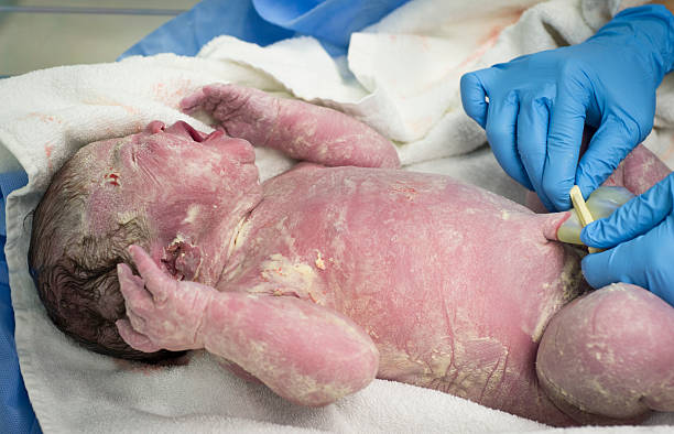 New born baby girl with clamped umbilical cord stock photo