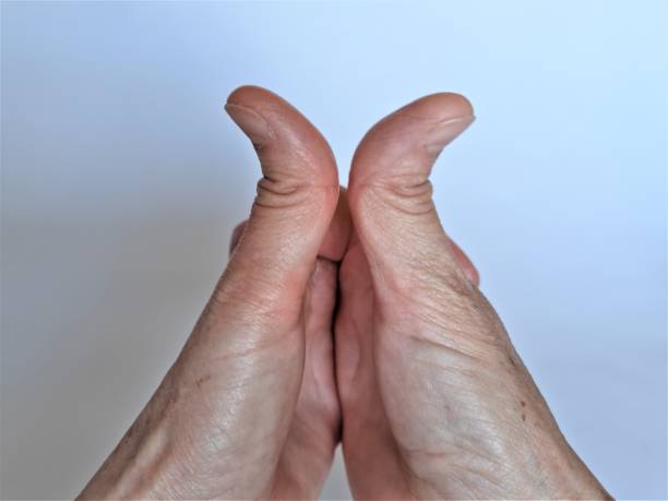 istock A pair of hands where the thumbs can bend 90 degrees 1400983657