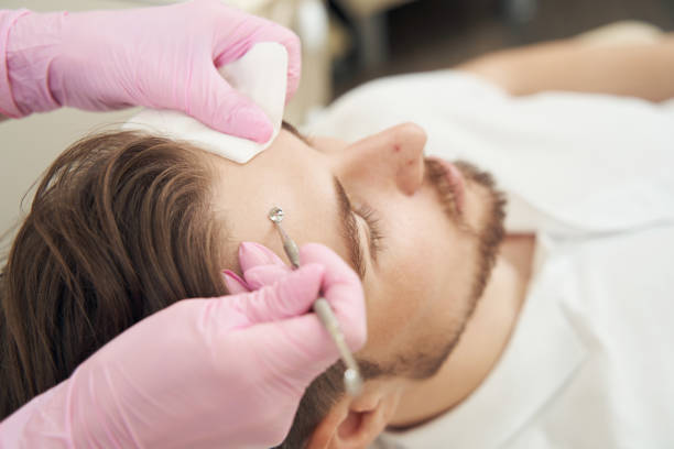 istock Beauty specialist cleaning pores on forehead with uno spoon 1400996607
