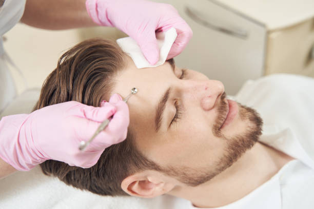 istock Beauty worker pressing uno spoon to man forehead 1400996618