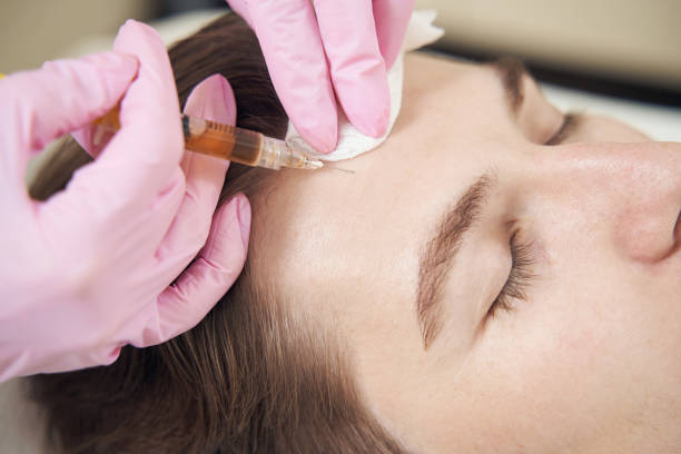 istock Syring injecting plasma into man head skin for wrinkle smoothing 1400996785