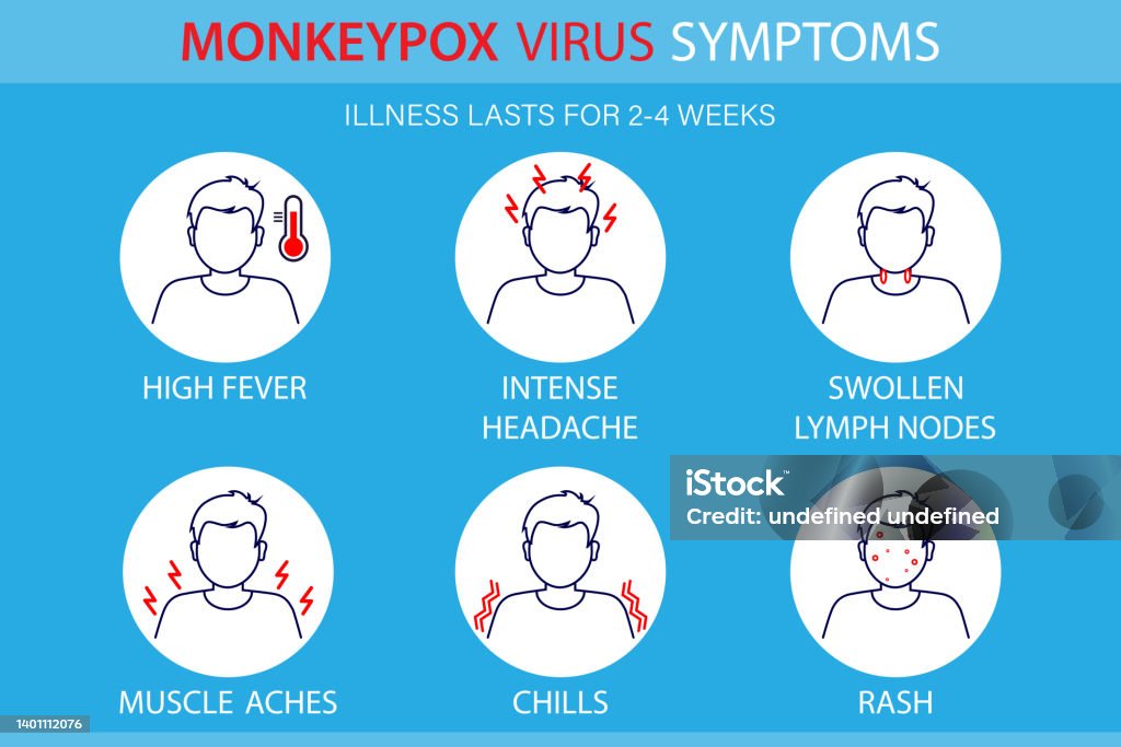 Symptoms of the monkeypox virus. Symptoms of the monkeypox virus.  Monkey pox is spreading. This causes skin infections. Infographic of symptoms of the monkeypox virus Monkeypox stock vector
