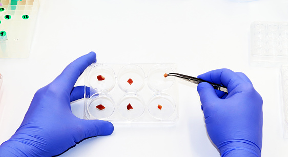 A scientist holds a multi-well plate with pieces of raw cultured meat in the biotechnology laboratory. Synthetic or in vitro meat production concept.  Cultured meat.