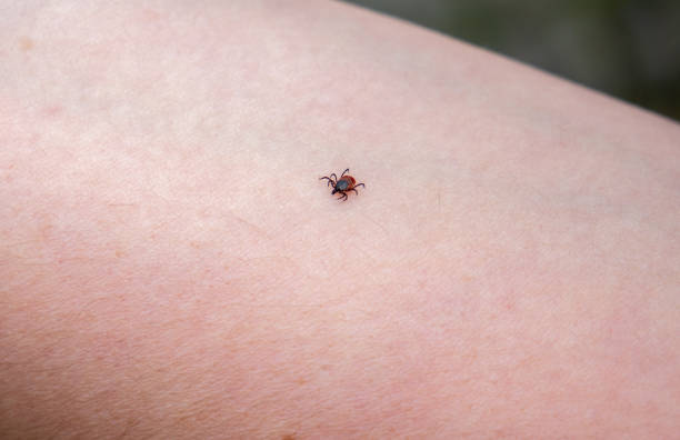 istock Tick 