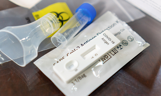 Stock photo showing close-up, elevated view of lab test labelled glass test tube and plastic sample pot besides completed medical form for Monkeypox (Poxviridae) virus test.