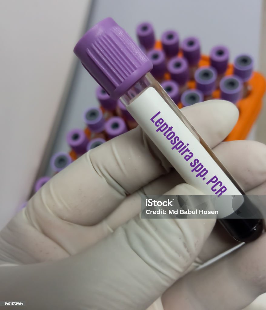 Blood Sample For Leptospira Spp Pcr Test To Identify Leptospirosis Blood Sample For Leptospira Spp Pcr Test To Identify Leptospirosis