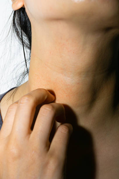 istock neck skin disease 1401186202
