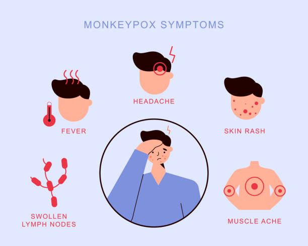 Monkeypox virus symptoms Monkeypox sympoms infographics on infected man. Headache, fever, swollen lymph nodes, muscle aches, skin rash. Orthopoxvirus awareness concept mpox stock illustrations