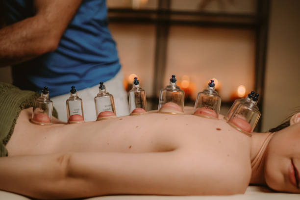 junge frau wird von einem therapeuten im spa-salon mit schröpfen behandelt - acupuncture cupping stock-fotos und bilder