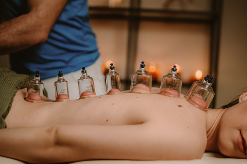 Beautiful young woman receiving cupping treatment on back while lying on spa bed by male therapist at beauty salon