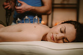Young woman getting cupping treatment by therapist at spa salon