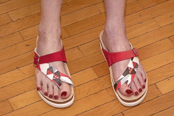 woman foot in summer sandals