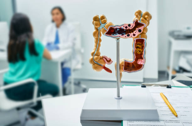 Gastroenterology consultation. Anatomical intestines model on doctor table over background gastroenterologist consulting female patient at medical clinic Gastroenterology consultation. Anatomical intestines model on doctor table over background gastroenterologist consulting female patient at medical clinic colon stock pictures, royalty-free photos & images